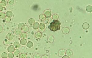 Imagen al miscroscopio de sedimento urinario canino con cristal de urato de amonio