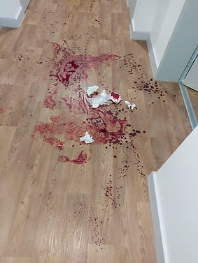 Trauma clean up blood and bodily fluids