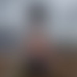 Hot & Cold Therapy: Do’s and Don’ts