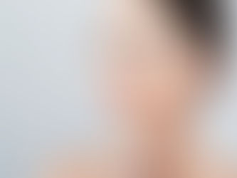 Liquid Facelift: A Non-Surgical Lift That Lasts
