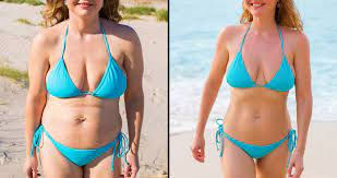 Body Jet Liposuction: Innovative Fat Removal for a Slimmer You