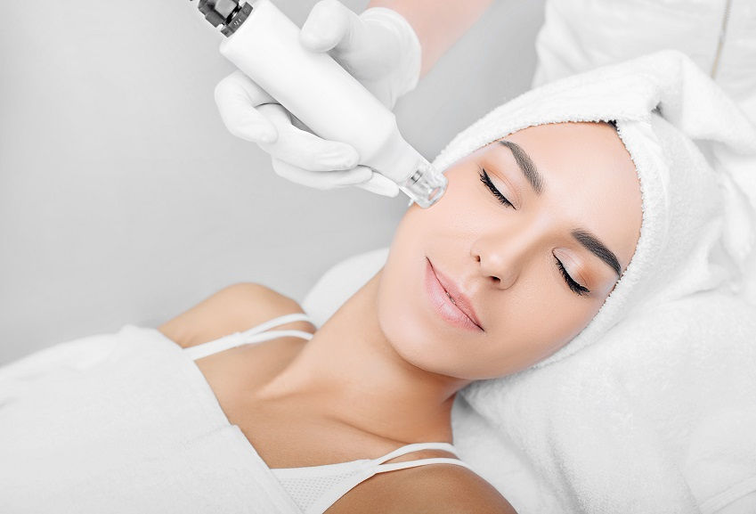 Does Microneedling Improve Skin Tone?