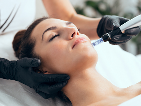 What is the Success Rate of Microneedling