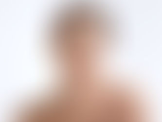 طبيب الأمراض الجلدية في دبي: اختيارك المثالي لتبييض البشرة