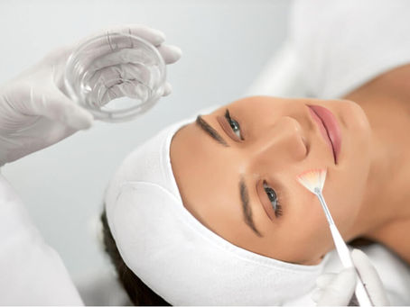 Can Salicylic ACID Peel Remove Deep Acne Marks?