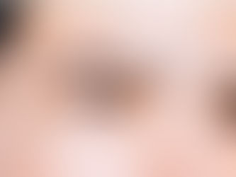 Change Your Look with Eyebrow Hair Transplant Plan