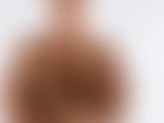 Male Breast Reduction Surgery Dubai: How It Works