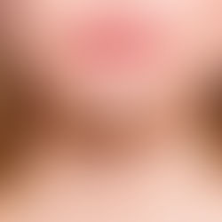 The Benefits of Lip Enlargement You Should Know