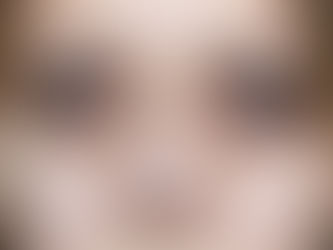 Dark Circles Removal In Dubai: Treatments That Shine