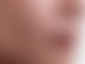 What happens during a pigmentation treatment?