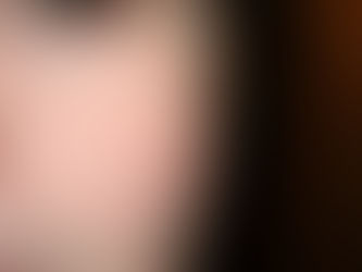 How to Find the Best Surgeon for Facial Scars Dubai