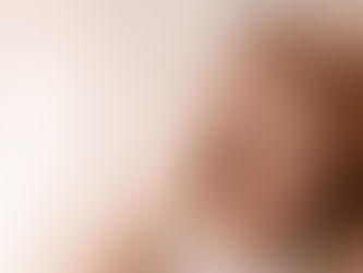 Can Female Hair Transplant Improve Confidence