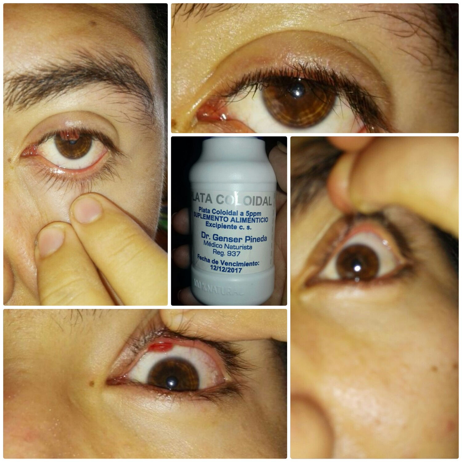 Plata Coloidal en gotas, 15 ml