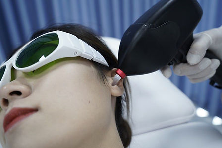 Depilacion laser en Veyo