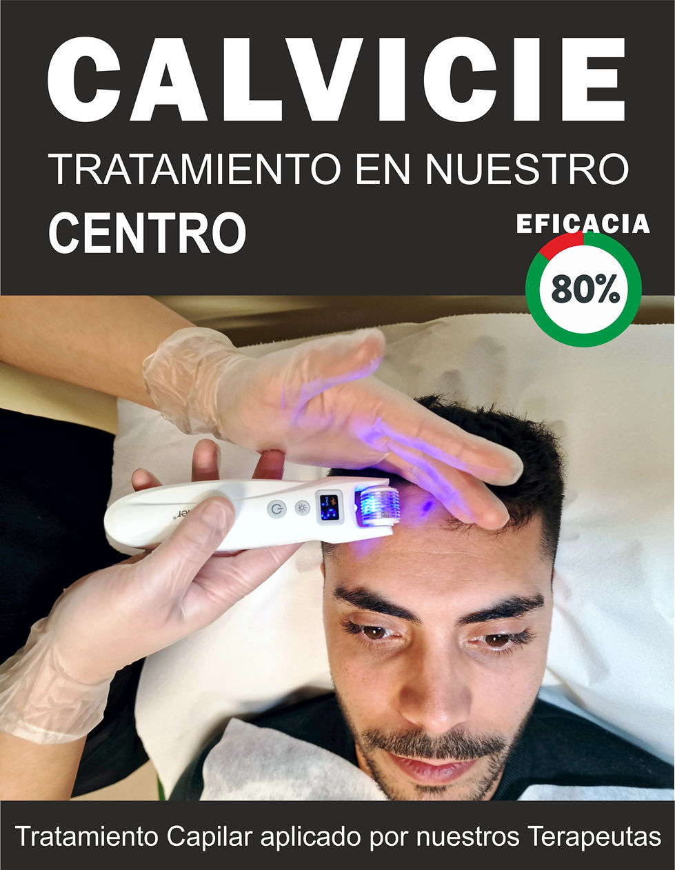 Calvicie Centro.jpg