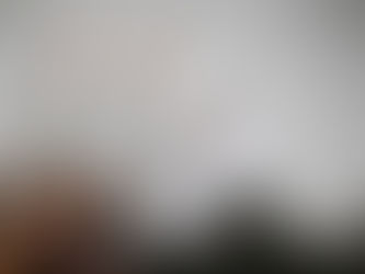 Hantavirus Terdeteksi di Indonesia