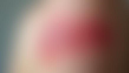 skin with staphylococcus aureus infection