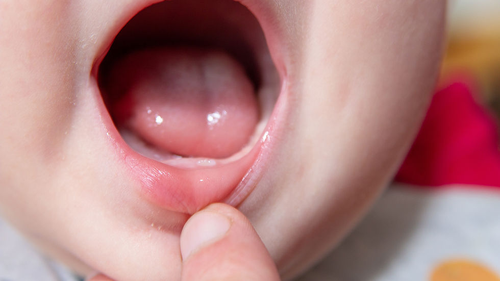 Babys-first-tooth-and-primary-teeth-eruption.jpg