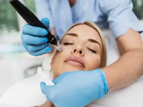 Pourquoi opter pour le Skin Needling à Gardanne ? 5 bienfaits pour la peau