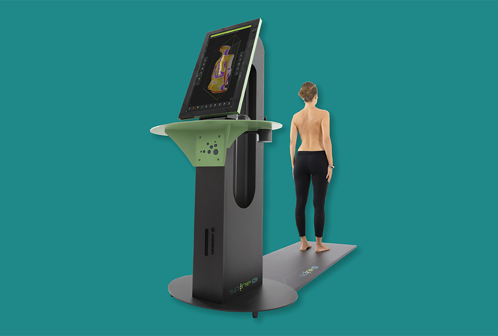 Spine3D frontal sagittal and transverse plane analysis of spinal deformity