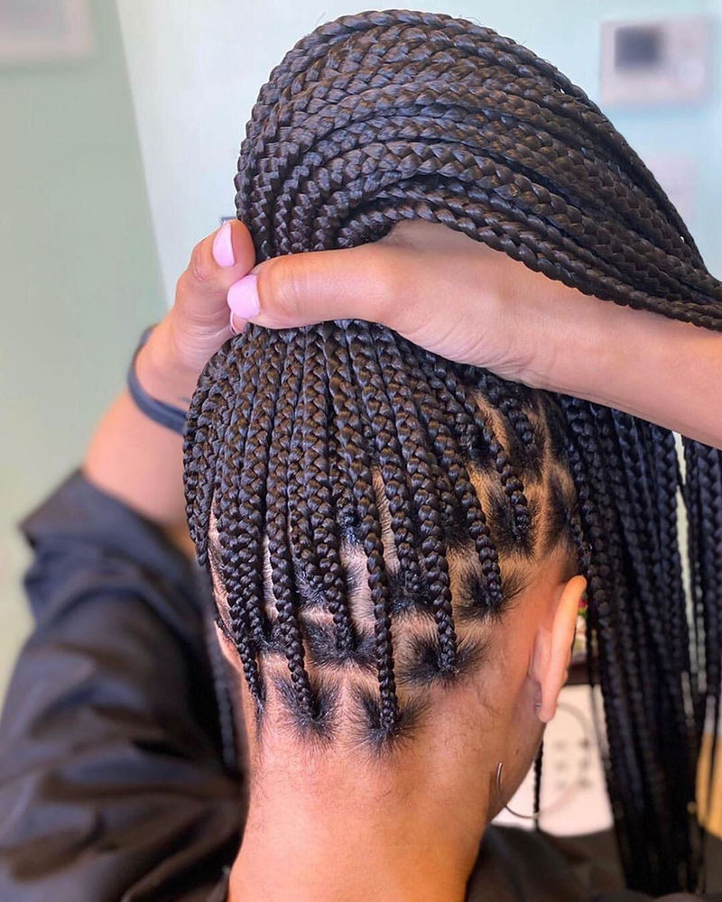 how-to-avoid-a-flaky-scalp-in-braids