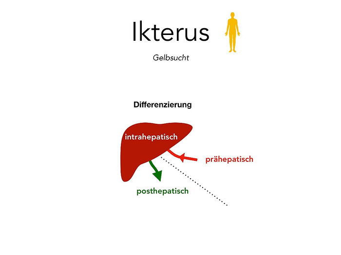 Ikterus, Gelbsucht