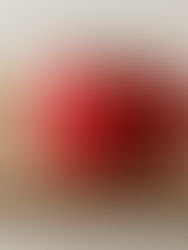 From 36 to 58 Minutes: Progress in Aged Care Dietetic Support, With More Work Ahead