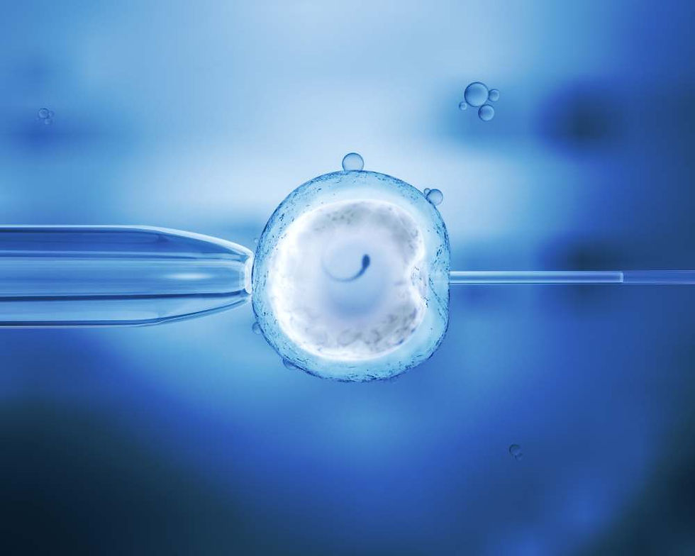 Fertilização in vitro. Procedimento realizado pela dra. ana elisa Tavares especialista em infertilidade são paulo Sp