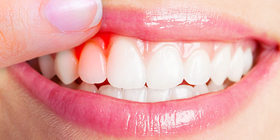 masseroni-studio-dentistico-aquila-parod