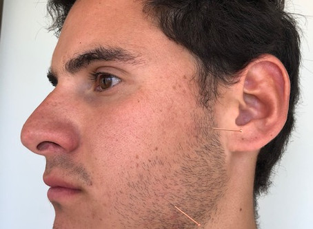 Rechinas los dientes? sabes lo que es el Bruxismo?