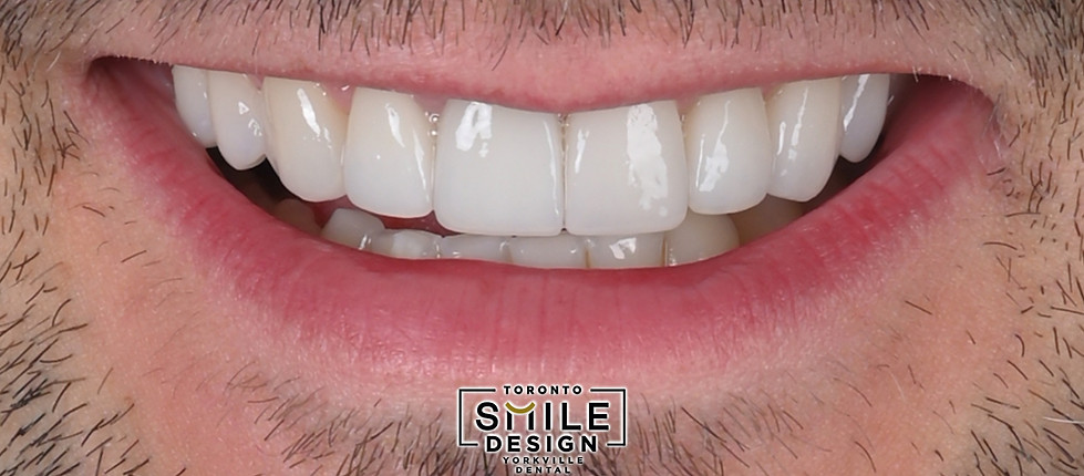 Cosmetic Dentistry in Toronto_edited.jpg