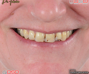 Toronto Smile Design - Cosmetic Dentist 