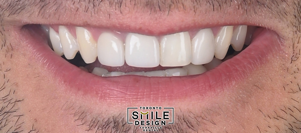 Cosmetic Dentistry in Toronto_edited.jpg