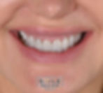 Cosmetic Dentistry in Toronto.001