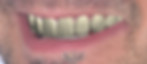 Cosmetic Dentistry in Toronto.025.jpeg