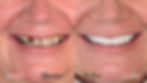 ree