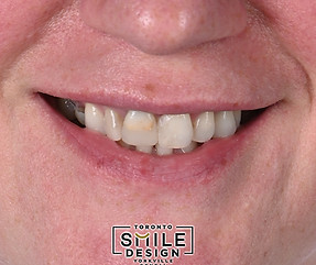 best cosmetic dentist in Toronto.001.jpeg