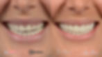 ree