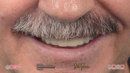 Smile Design Toronto - Toronto Cosmetic Dentist.jpeg