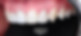 Cosmetic Dentistry in Toronto_edited.jpg