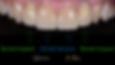 Toronto Dental Implants - dental implant