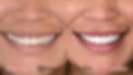 ree