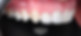 Cosmetic Dentistry in Toronto_edited.jpg