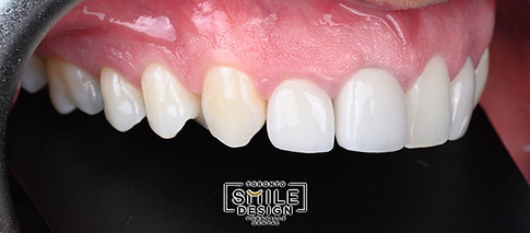 Cosmetic Dentistry in Toronto_edited.jpg