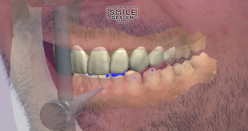 Cosmetic Dentistry in Toronto.026.jpeg