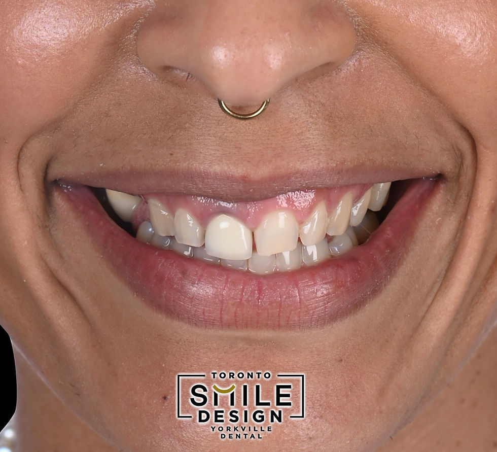 Cosmetic Dentistry in Toronto.001