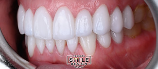 Best Cosmetic Dentistry in Toronto_edited.jpg
