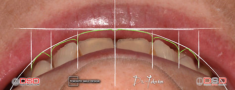 Dentist Toronto - Smile Makeover.jpeg