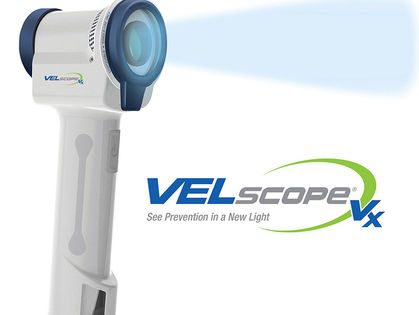 Pioneering the Early Detection of Oral Cancer with Velscope at Toronto Smile Design