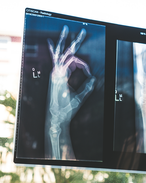 xray.png